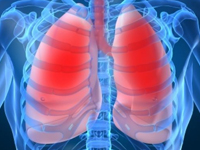 Применение лазерного пневмолиза в коллапсотерапии туберкулеза легких